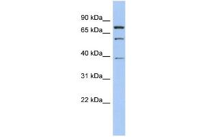 WB Suggested Anti-MOSPD2 Antibody Titration: 0. (MOSPD2 抗体  (Middle Region))