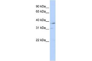 WB Suggested Anti-NR1I3 Antibody Titration:  0. (NR1I3 抗体  (Middle Region))