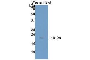 Western blot analysis of the recombinant protein. (RBP2 抗体  (AA 1-134))