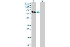 Western Blot analysis of SMU1 expression in transfected 293T cell line by SMU1 MaxPab polyclonal antibody. (SMU1 抗体  (AA 1-513))
