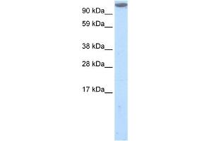 WB Suggested Anti-MKL1 Antibody Titration:  1. (MKL1 抗体  (C-Term))
