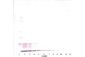 Image no. 2 for anti-Interleukin 15 (IL15) antibody (ABIN464931) (IL-15 抗体)