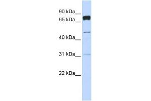 PLEKHA4 antibody used at 1 ug/ml to detect target protein. (PLEKHA4 抗体  (Middle Region))