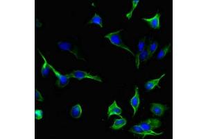 Immunofluorescent analysis of Hela cells using ABIN7156895 at dilution of 1:100 and Alexa Fluor 488-congugated AffiniPure Goat Anti-Rabbit IgG(H+L) (IL-33 抗体  (AA 123-276))