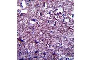 Formalin fixed and paraffin embedded human brain tissue reacted with DISC1 Antibody (C-term) followed by peroxidase conjugation of the secondary antibody and DAB staining.