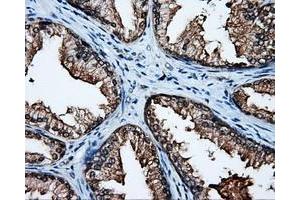 Immunohistochemistry (IHC) image for anti-Amyloid beta (A4) Precursor Protein (APP) antibody (ABIN1496876) (APP 抗体)