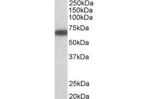 Western Blotting (WB) image for anti-Glutamate Decarboxylase 1 (Brain, 67kDa) (GAD1) (AA 52-62) antibody (ABIN1101656) (GAD 抗体  (AA 52-62))