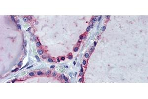 Immunohistochemistry (IHC) image for anti-Kinesin Family Member 20A (KIF20A) (Middle Region) antibody (ABIN2792240)