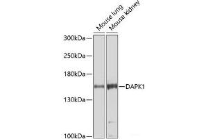 Western blot analysis of extracts of various cell lines using DAPK1 Polyclonal Antibody at dilution of 1:1000. (DAP Kinase 1 抗体)