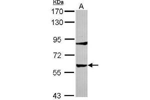 WB Image Sample (30 ug of whole cell lysate) A: IMR32 7. (Tyrosine Hydroxylase 抗体)