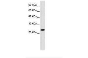 Image no. 2 for anti-Regulator of G-Protein Signaling 13 (RGS13) (AA 77-126) antibody (ABIN202034) (RGS13 抗体  (AA 77-126))