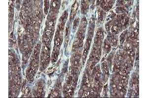 Image no. 7 for anti-TSC22 Domain Family, Member 1 (TSC22D1) antibody (ABIN1501540)