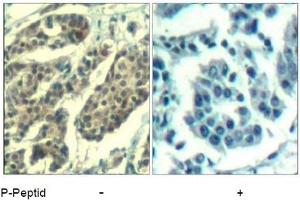 Image no. 1 for anti-Cyclin B1 (CCNB1) (pSer147) antibody (ABIN401595) (Cyclin B1 抗体  (pSer147))