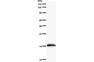 Western Blotting (WB) image for anti-Forkhead Box L2 (FOXL2) antibody (ABIN931144)