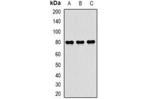 Western blot analysis of TAP2 expression in MCF7 (A), mouse spleen (B), mouse lung (C) whole cell lysates. (TAP2 抗体)