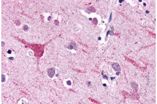 NPFFR2 抗体  (Extracellular Domain)