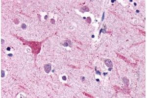 Anti-NPFFR2 antibody  ABIN1049116 IHC staining of human brain, neurons and glia. (NPFFR2 抗体  (Extracellular Domain))
