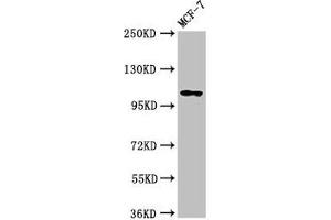 Western Blot Positive WB detected in: MCF-7 whole cell lysate All lanes: PSD antibody at 3. (PSD 抗体  (AA 247-489))