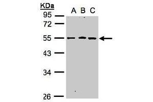WB Image Sample(30 ug whole cell lysate) A:A431, B:H1299 C:HeLa S3, 10% SDS PAGE antibody diluted at 1:1000 (RGMB 抗体  (Center))