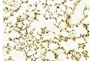 ABIN6272997 at 1/100 staining Mouse lung tissue by IHC-P. (ELAC2 抗体  (N-Term))