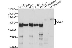 Western blot analysis of extracts of various cell lines, using LDLR antibody (ABIN6290562) at 1:1000 dilution. (LDLR 抗体)