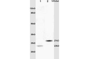 Lane 1: rat brain lysates Lane 2: human colon carcinoma lysates probed with Anti CPSF4/CPSF30 Polyclonal Antibody, Unconjugated (ABIN1386751) at 1:200 in 4 °C.
