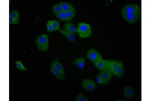 Immunofluorescence staining of HepG2 cells with ABIN7167795 at 1:200, counter-stained with DAPI. (Retinoic Acid Early Transcript 1E (RAET1E) (AA 31-225) 抗体)