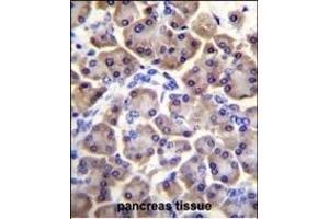 MRPS12 Antibody (Center K43) (ABIN656569 and ABIN2845829) immunohistochemistry analysis in formalin fixed and paraffin embedded human pancreas tissue followed by peroxidase conjugation of the secondary antibody and DAB staining. (MRPS12 抗体  (AA 28-59))