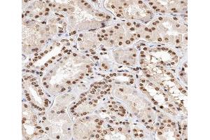 ABIN6267347 at 1/200 staining human kidney tissue sections by IHC-P. (Histone H2A 抗体  (pThr121))