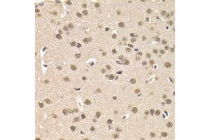 Immunohistochemistry of paraffin-embedded mouse brain using CSNK1E antibody at dilution of 1:200 (400x lens). (CK1 epsilon 抗体)