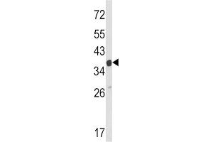 Western Blotting (WB) image for anti-Actin Related Protein 2/3 Complex, Subunit 1A, 41kDa (ARPC1A) antibody (ABIN3002659)