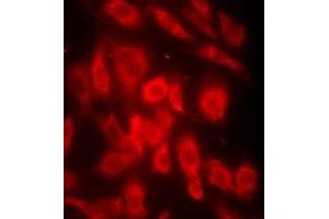 Immunofluorescent analysis of OMI staining in MCF7 cells. (HTRA2 抗体)