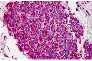 Human Breast: Formalin-Fixed, Paraffin-Embedded (FFPE) (CAPN1 抗体)