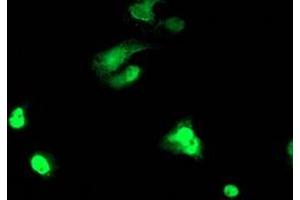 Image no. 3 for anti-T-Cell Acute Lymphocytic Leukemia 1 (TAL1) antibody (ABIN1501288)
