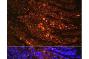 Immunofluorescence analysis of Rat Intestine using TLN1 Polyclonal Antibody at dilution of 1:100. (TLN1 抗体)