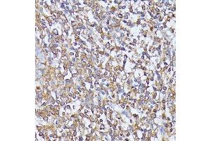Immunohistochemistry (IHC) image for anti-serine/threonine Kinase 24 (STK24) (AA 312-431) antibody (ABIN6148602)