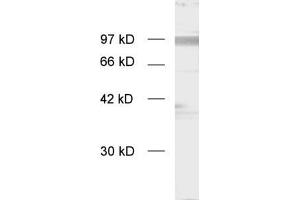 dilution: 1 : 1000, sample: enriched synaptosomal membranes (APP 抗体  (C-Term))