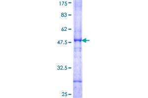 ACO2 Protein (AA 1-179) (GST tag)