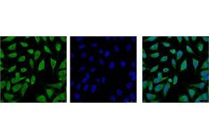 Immunofluorescence (IF) analysis of HeLa with antibody (Left) and DAPI (Right) diluted at 1:100. (HSP70 抗体)