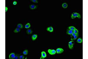Immunofluorescent analysis of A431 cells using ABIN7168723 at dilution of 1:100 and Alexa Fluor 488-congugated AffiniPure Goat Anti-Rabbit IgG(H+L) (SCAMP2 抗体  (AA 1-153))