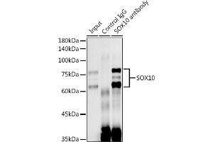 Immunoprecipitation analysis of 300 μg extracts of C6 cells using 3 μg SOX10 antibody (ABIN7270567). (SOX10 抗体)