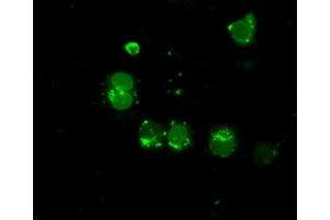Image no. 4 for anti-LEM Domain Containing 3 (LEMD3) antibody (ABIN1499117)