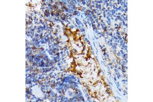 Immunohistochemistry of paraffin-embedded mouse spleen using T Rabbit mAb (ABIN7270916) at dilution of 1:100 (40x lens). (TACC3 抗体)
