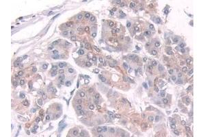 Detection of TPMT in Human Pancreas Tissue using Polyclonal Antibody to Thiopurine Methyltransferase (TPMT) (TPMT 抗体  (AA 26-227))