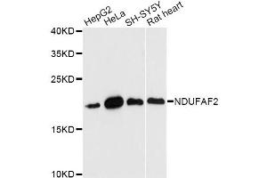 Western blot analysis of extracts of various cell lines, using NDUFAF2 antibody (ABIN6293812) at 1:3000 dilution. (NDUFAF2 抗体)