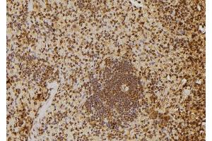 ABIN6277651 at 1/100 staining Rat spleen tissue by IHC-P. (MTR4 抗体  (Internal Region))