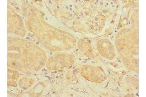 Immunohistochemistry of paraffin-embedded human kidney tissue using ABIN7152170 at dilution of 1:100 (EIF3K 抗体  (AA 1-218))