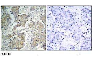 Image no. 3 for anti-VEGF Receptor 2 (VEGFR2) (pTyr1214) antibody (ABIN196768) (VEGFR2/CD309 抗体  (pTyr1214))