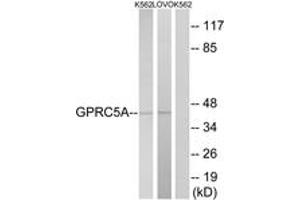 Western blot analysis of extracts from K562/LOVO cells, using GPRC5A Antibody.