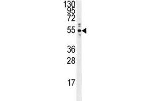 Western Blotting (WB) image for anti-Protein tyrosine Phosphatase, Non-Receptor Type 1 (PTPN1) antibody (ABIN3032393)